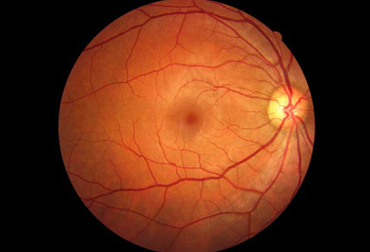 MEDICAL RETINA